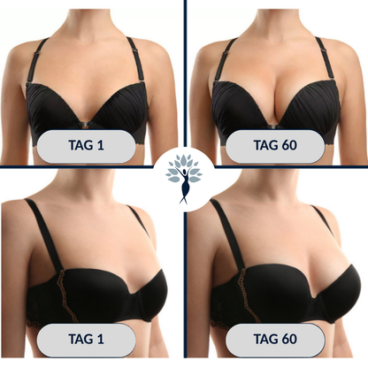 BUST'UP – plastry na biust